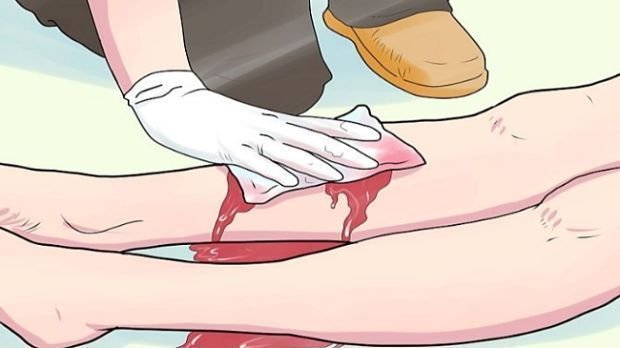 como detener el sangrado de una herida