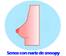 senos con nariz de snoopy