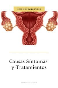 Ovarios poliquísticos Causas, Síntomas y Tratamientos