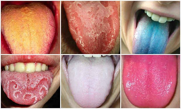 color de lengua