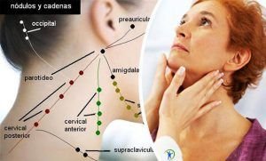 Porque se inflama los ganglios de la axila