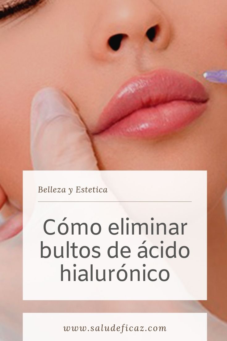 Como quitar bultos de acido hialuronico encapsulado | Salud Eficaz