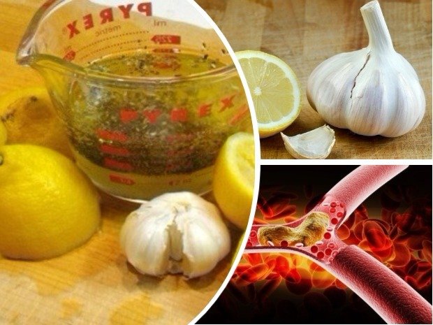 Mezcla ajo y limón para curar la ateriosclerosis y el colesterol