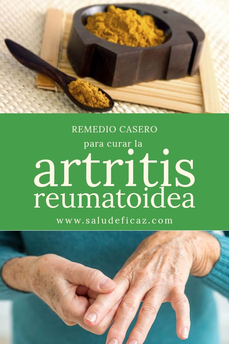 Los Mejores Remedios Naturales Para La Artritis Reumatoide Salud My