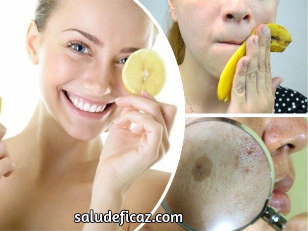 7 remedios caseros para quitar las manchas de la piel