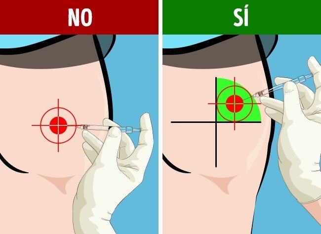 Cómo poner una inyección en la nalga sin dolor
